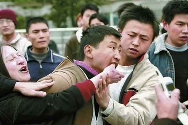 狂犬病是如何傳播的